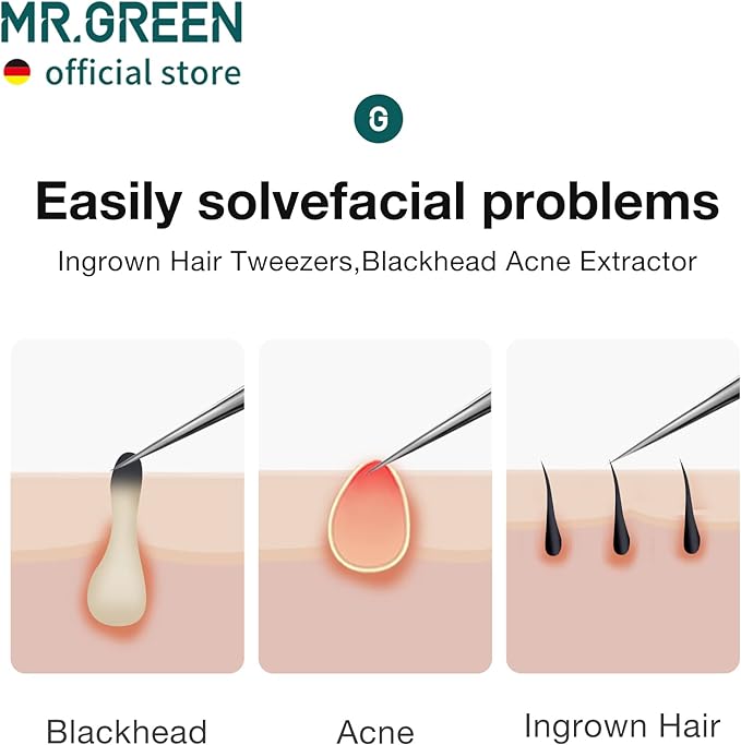 MR.GREEN Ingrown Hair Tweezers Needle Nose Pointed Tips Tweezers - Image 3