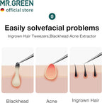 MR.GREEN Ingrown Hair Tweezers Needle Nose Pointed Tips Tweezers - Image 3