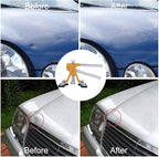 GLISTON Auto Dent Puller Kit - Image 6