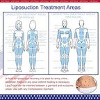 5 Pack Lipo Foam Pads for Post Surgery Ab Board Liposuction Surgery | - Image 5
